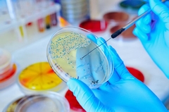 Different Types of Mold in Homes: Common Varieties Explained