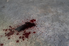 Crime Scene with Blood: How Professional Cleanup Works
