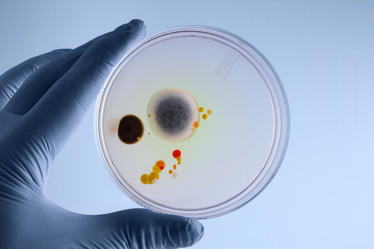 Basics of Finding Mold in Your Home - Types, Preventative Measures